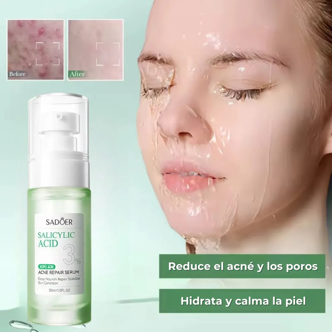 Suero ácido salicílico al 3% Sadoer