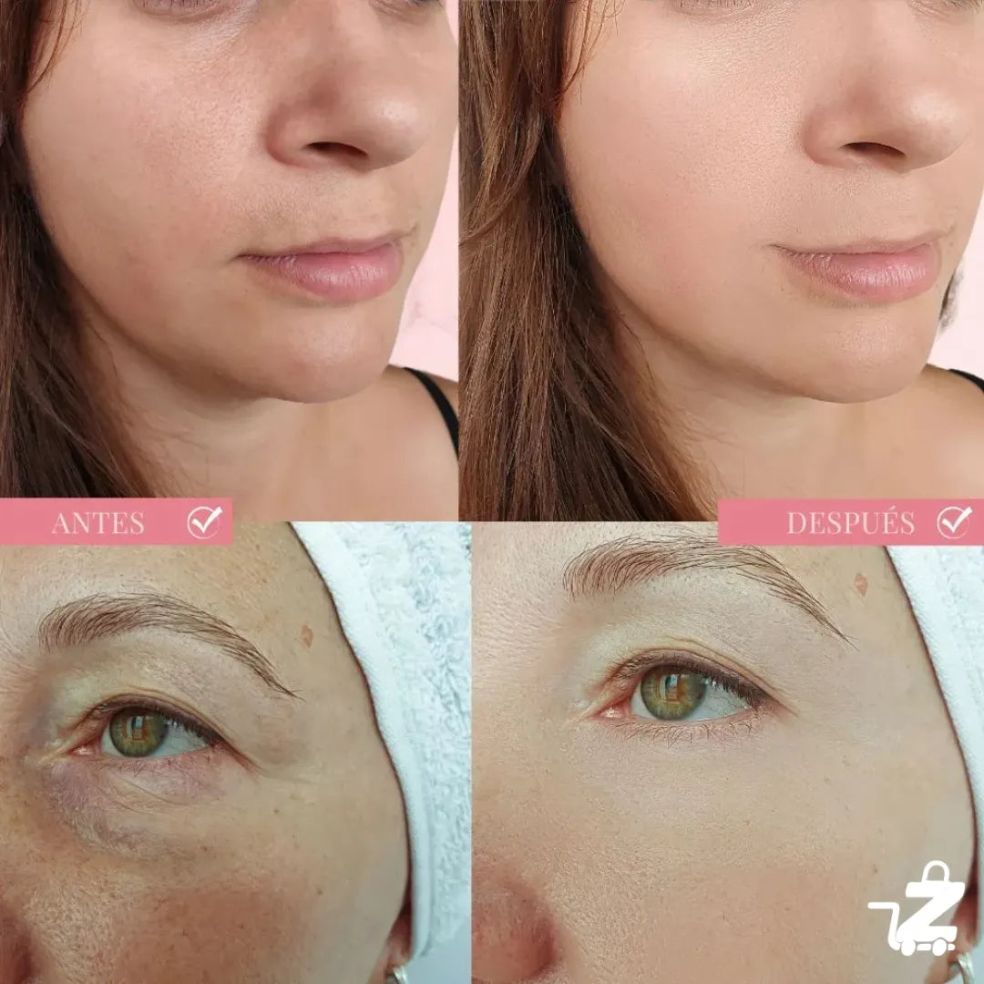 Serum Sadoer 4 en 1: Reparación Completa