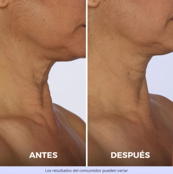 Crema Reafirmante Lifting para el Cuello