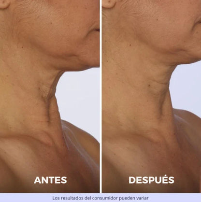 Crema Reafirmante Lifting para el Cuello